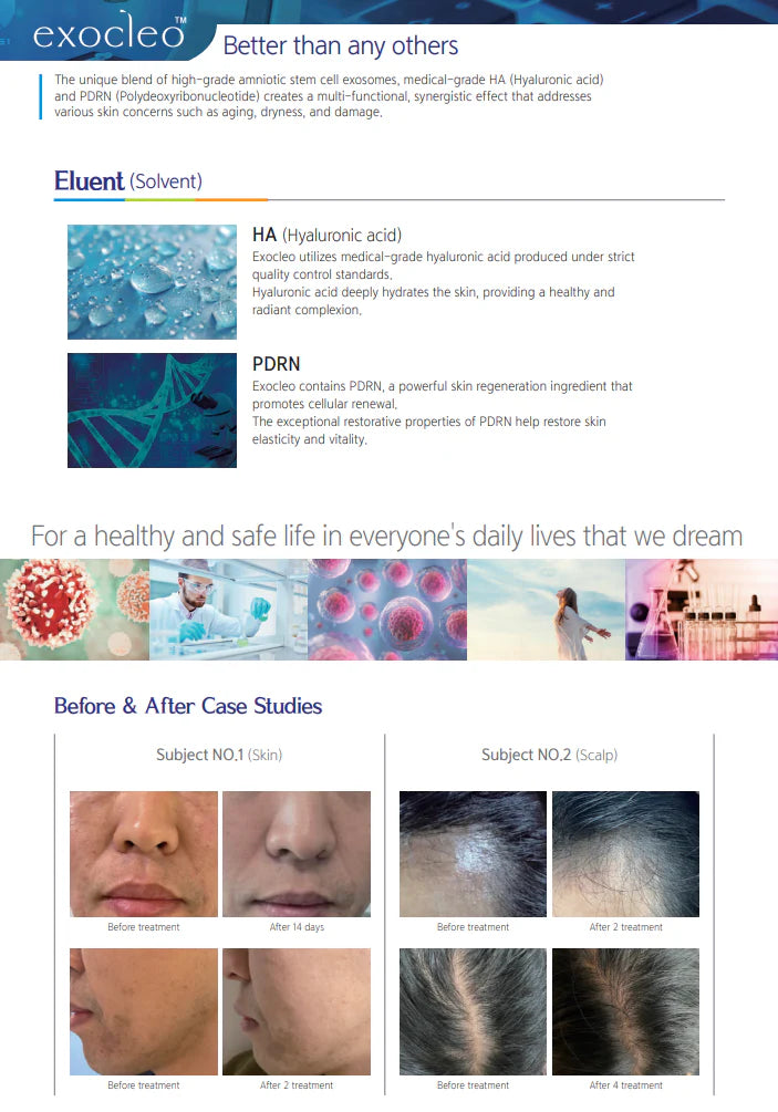Exocleo Ultimate Skin Rejuvenation Kit | Amniotic Exosome & PDRN Ampoule