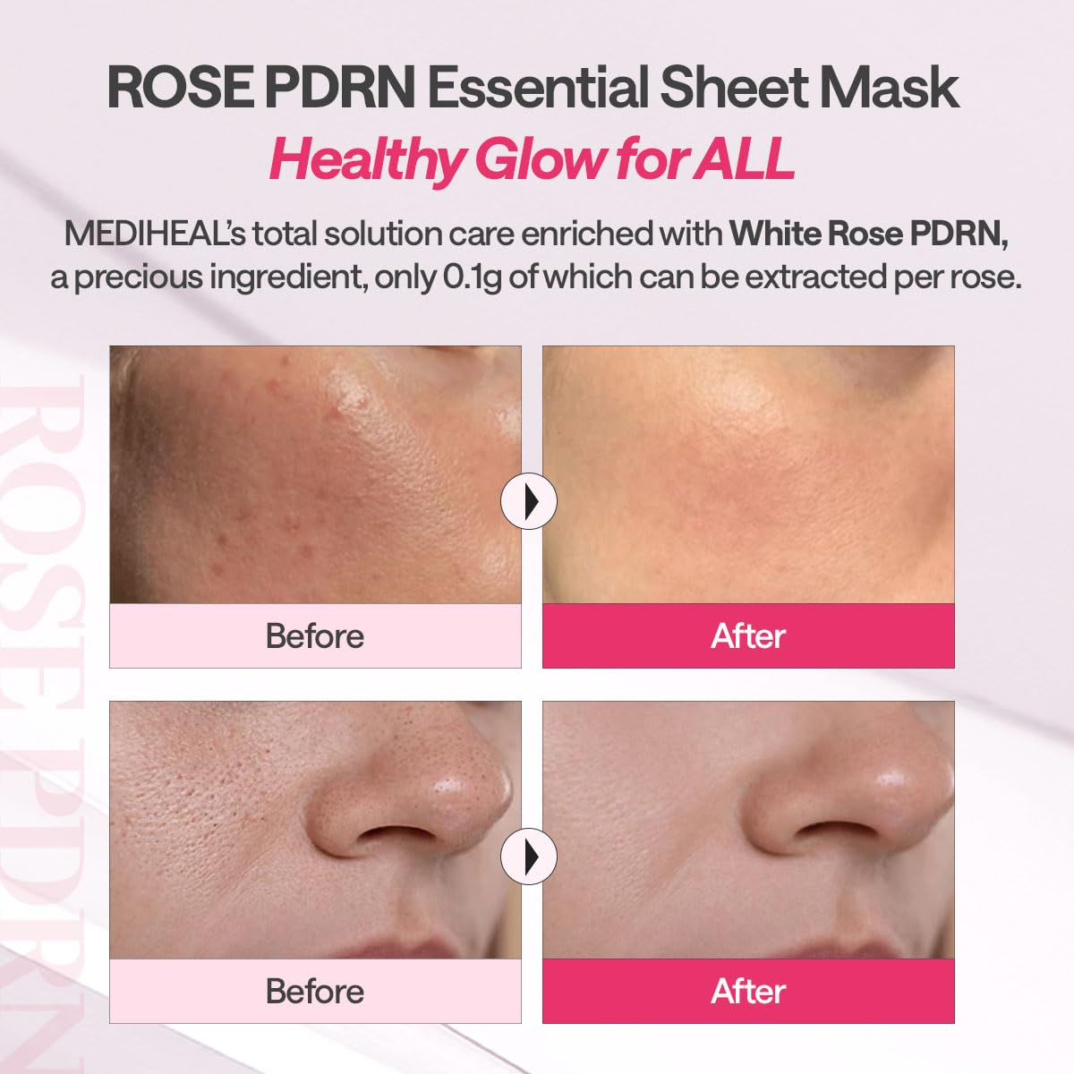 Mediheal Rose PDRN Essential Sheet Mask– 99% Pure White Rose PDRN & Hyaluronic Acid for hydrating – Wholesale K-Beauty (Pack of 10) (Copy)