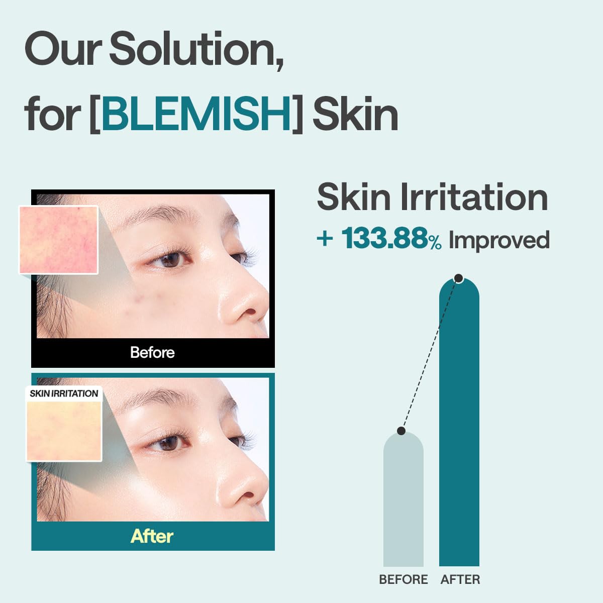 Mediheal Madecassoside Blemish Repair Mask – 98% Cica + Hydration + Soothing – Wholesale K-Beauty (Pack of 10)
