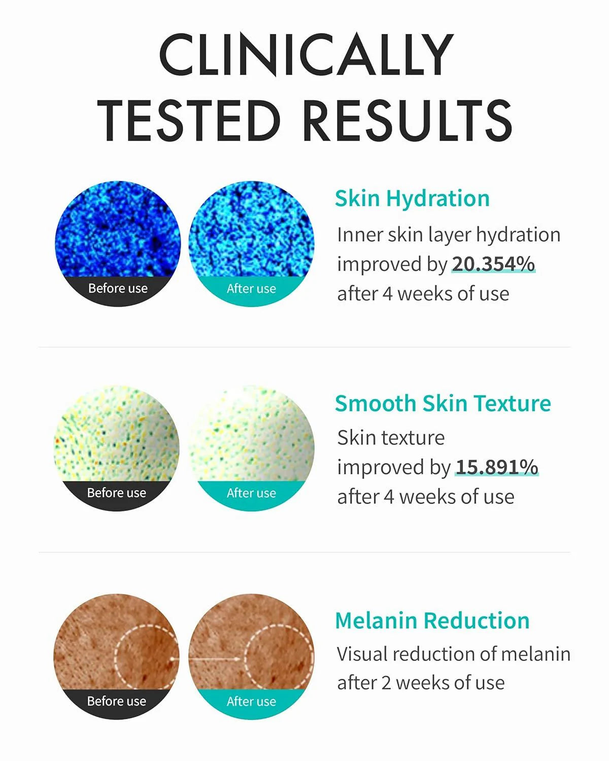REJURAN Turnover Cream Enhanced