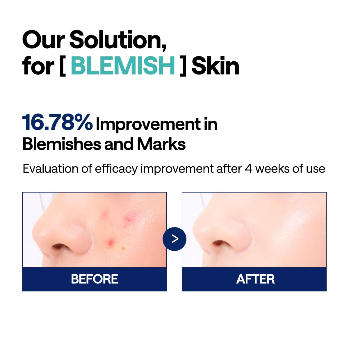 Mediheal Madecassoside Blemish Toner Pad – Calming Vegan Pads with Centella Asiatica for Acne-Prone Skin | Wholesale K-Beauty
