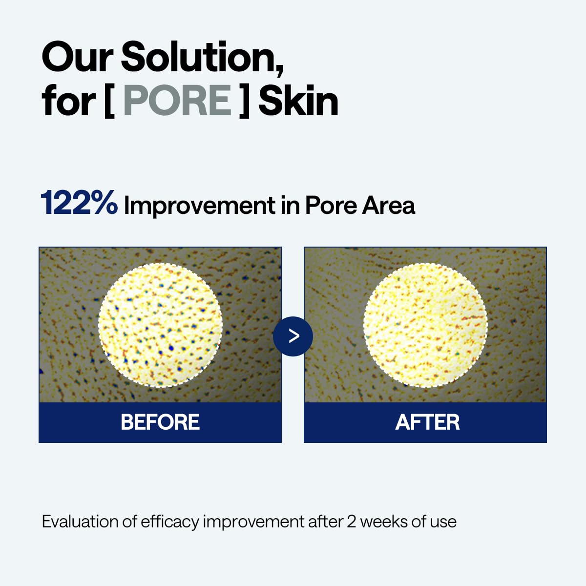 Mediheal Madecassoside Pore Repair Serum with Spicule | Wholesale K-Beauty