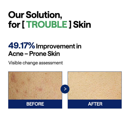 Mediheal Teatree Trouble Toner Pad – Calming & Soothing Vegan Gauze Pads for Acne-Prone Skin | Wholesale K-Beauty