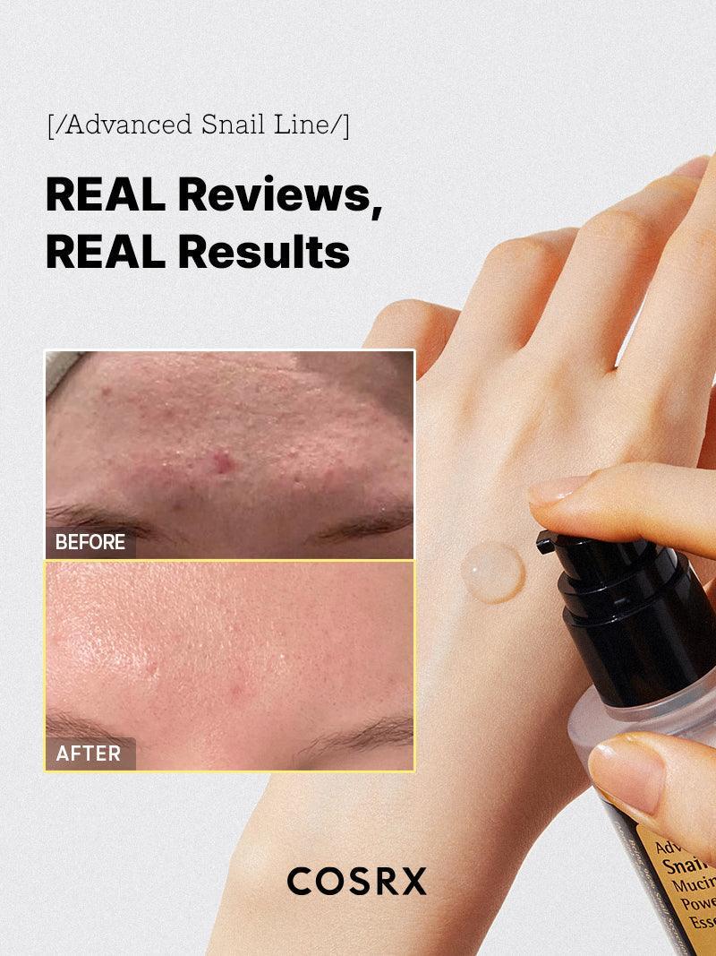 COSRX Advanced Snail 96 Mucin Power Essence 100mL | Wholesale K-Beauty