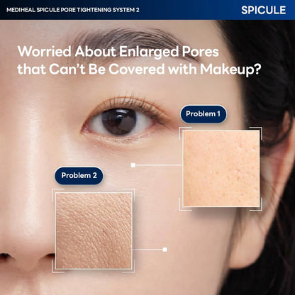 Comparison of enlarged pores before and after using Mediheal Spicule Pore Tightening System 1